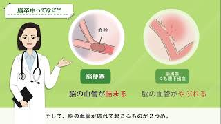 脳卒中ってなに？